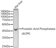 Prostatic Acid Phosphatase (PSAP)  Rabbit mAb
