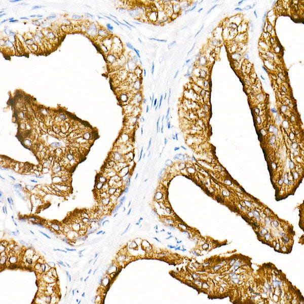 Prostatic Acid Phosphatase (PSAP)  Rabbit mAb