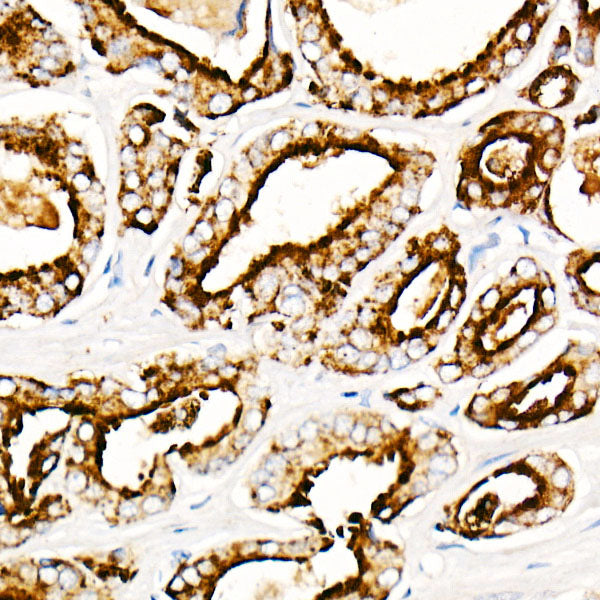Prostatic Acid Phosphatase (PSAP)  Rabbit mAb