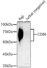 CD86 Rabbit mAb