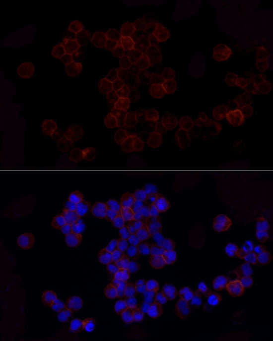CD86 Rabbit mAb