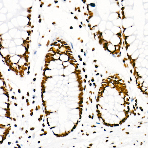 Symmetric DiMethyl-Histone H3-R8 Rabbit mAb