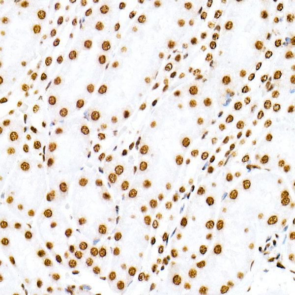 Symmetric DiMethyl-Histone H3-R8 Rabbit mAb