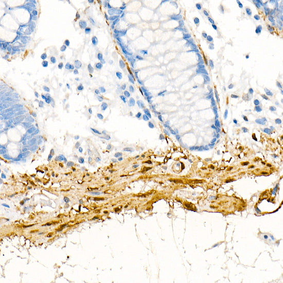 Transgelin (TAGLN) Rabbit mAb