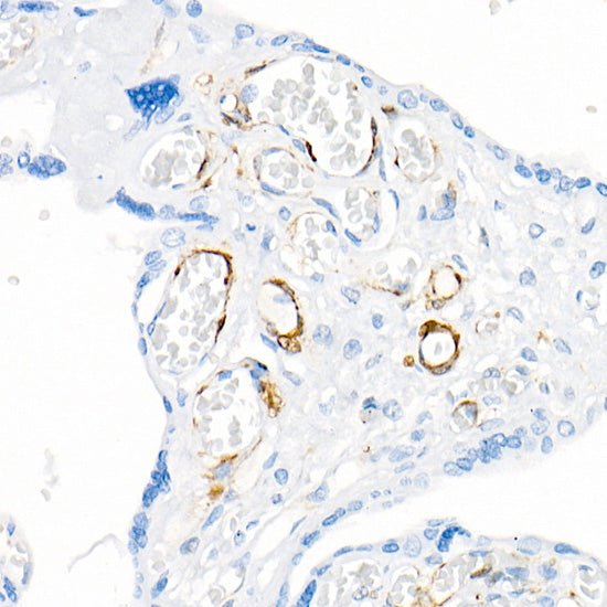 Transgelin (TAGLN) Rabbit mAb