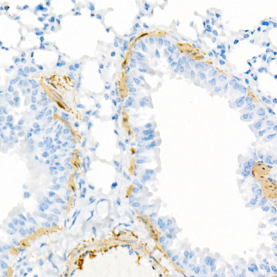 Transgelin (TAGLN) Rabbit mAb