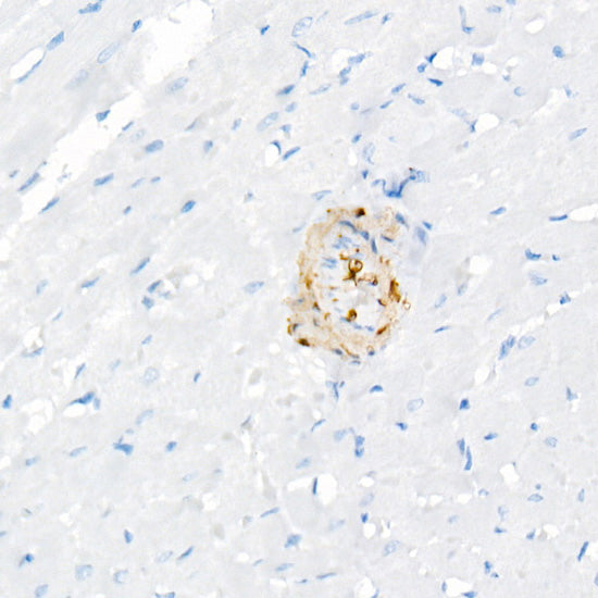 Transgelin (TAGLN) Rabbit mAb