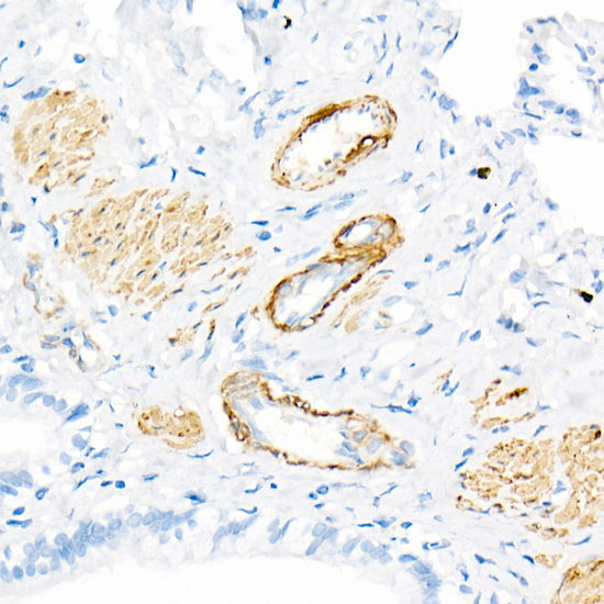 Transgelin (TAGLN) Rabbit mAb