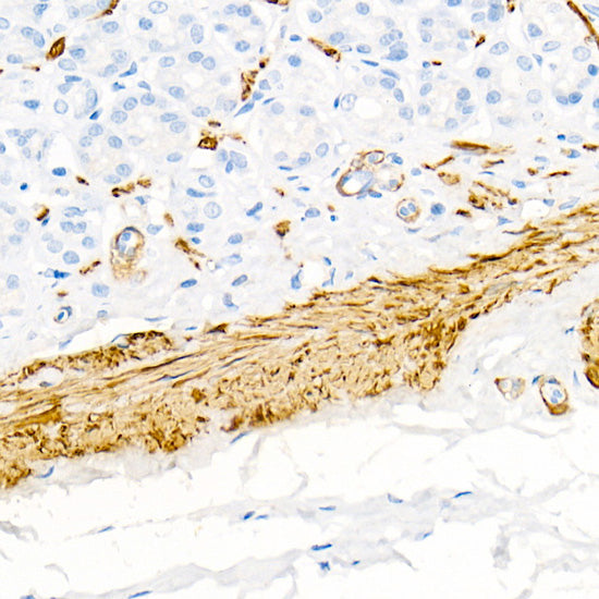 Transgelin (TAGLN) Rabbit mAb