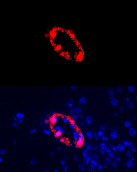 Transgelin (TAGLN) Rabbit mAb