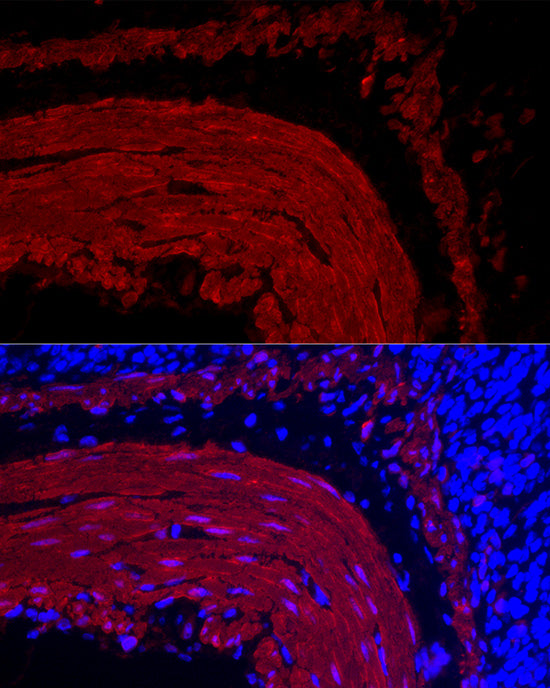 Transgelin (TAGLN) Rabbit mAb
