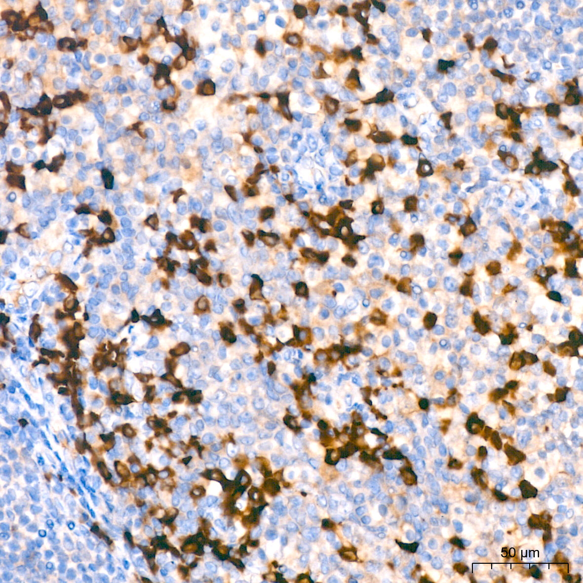 human IgG (Fc) Mouse mAb