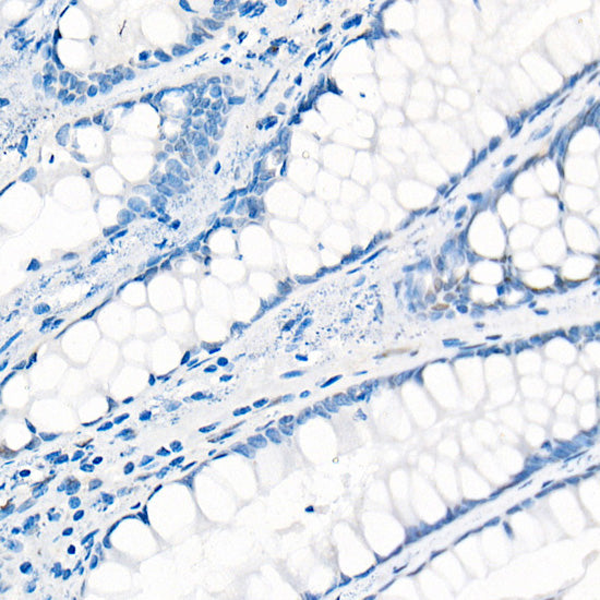 [KO Validated] YAP1 Rabbit mAb