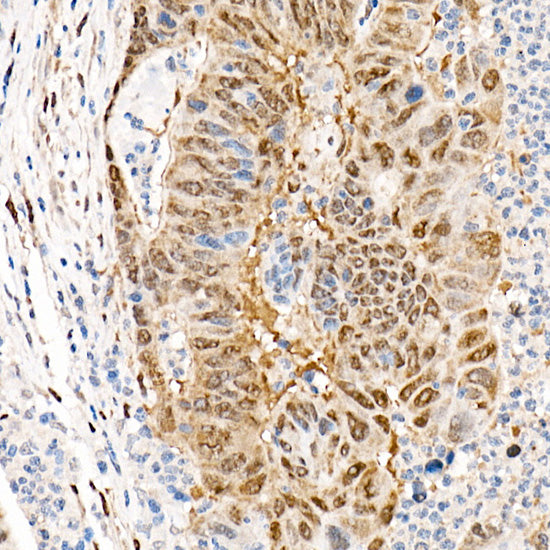 [KO Validated] YAP1 Rabbit mAb