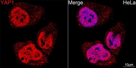 [KO Validated] YAP1 Rabbit mAb