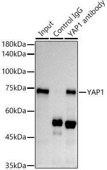 [KO Validated] YAP1 Rabbit mAb