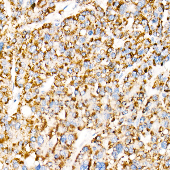 ACOX1 Rabbit mAb