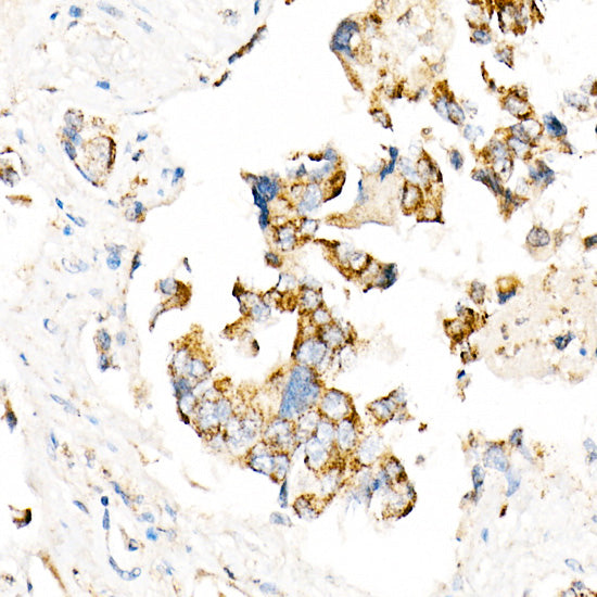 ACOX1 Rabbit mAb