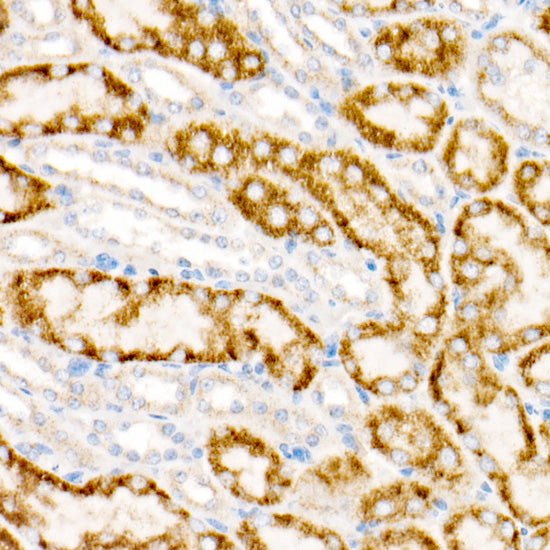 ACOX1 Rabbit mAb