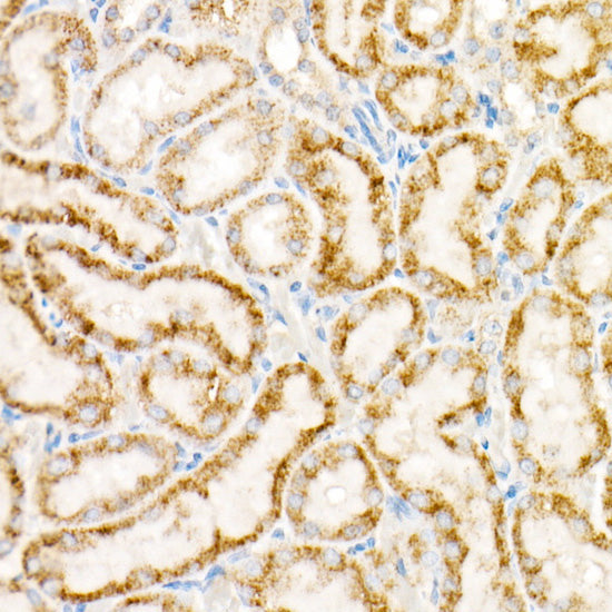 ACOX1 Rabbit mAb