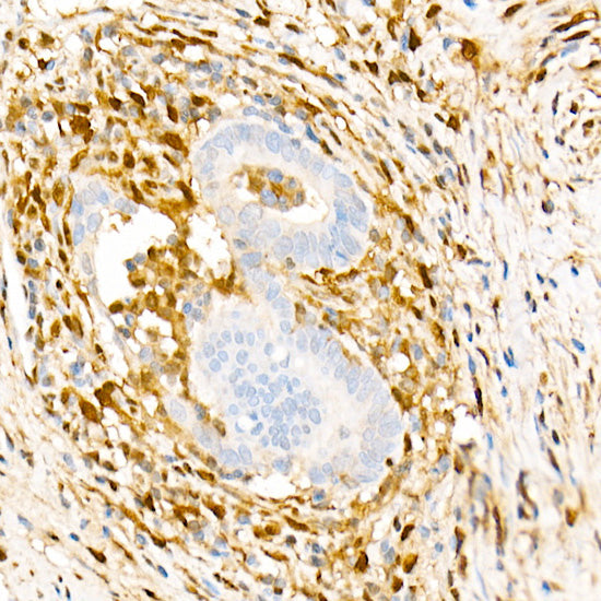 Galectin 1/LGALS1 Rabbit mAb