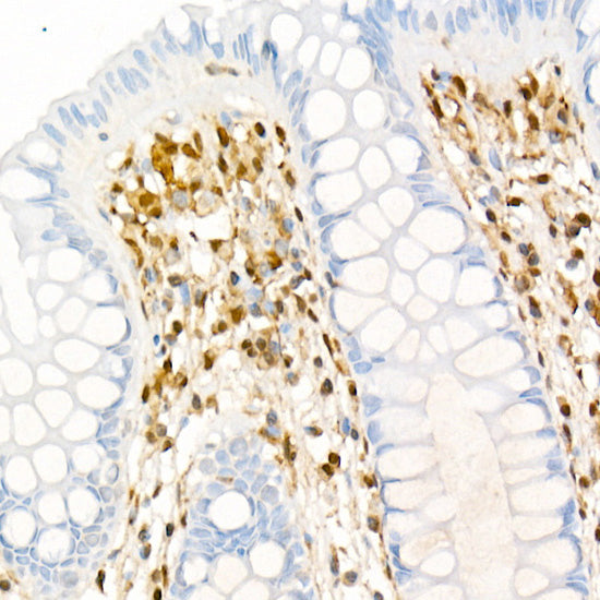 Galectin 1/LGALS1 Rabbit mAb