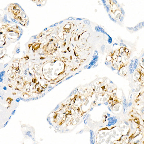 Galectin 1/LGALS1 Rabbit mAb
