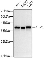 eIF2α Rabbit mAb