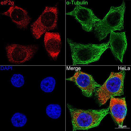 eIF2α Rabbit mAb
