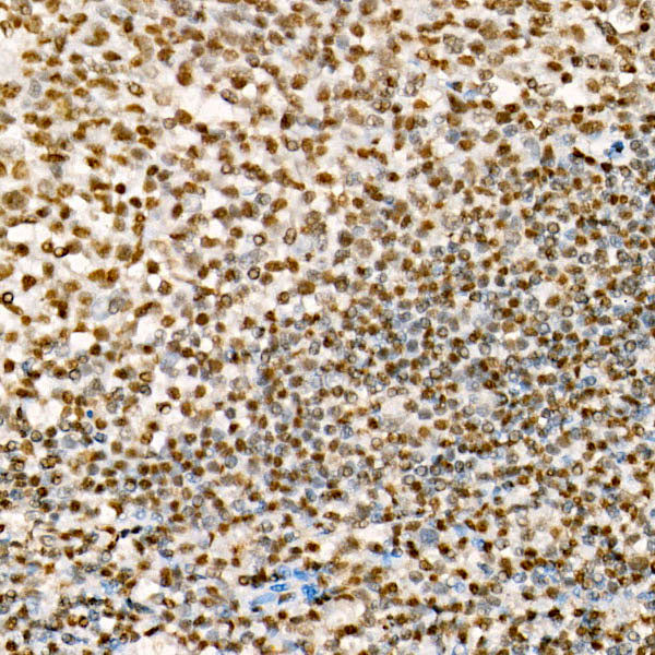 MonoMethyl-Histone H3-K79 Rabbit mAb