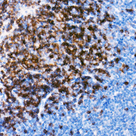 CD79B Rabbit mAb