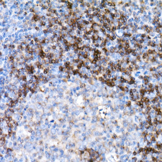 CD79B Rabbit mAb