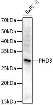 PHD3 Rabbit mAb