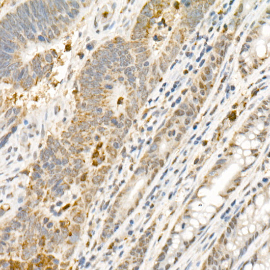 PHD3 Rabbit mAb