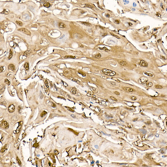 PHD3 Rabbit mAb