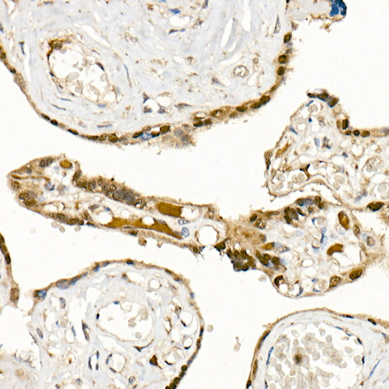 PHD3 Rabbit mAb