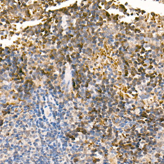 PHD3 Rabbit mAb