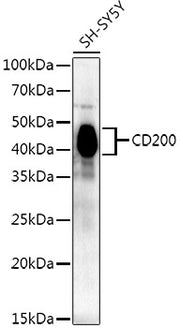 CD200 Rabbit mAb