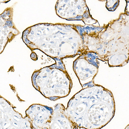 CD200 Rabbit mAb