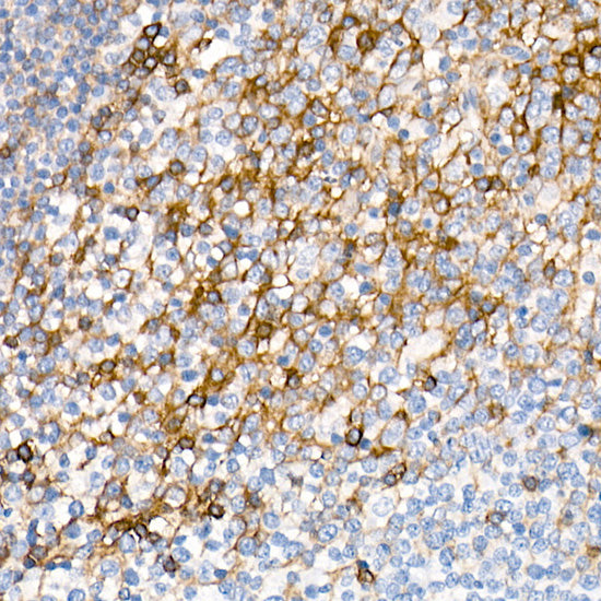CD200 Rabbit mAb