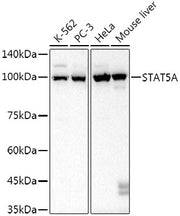 STAT5A Rabbit mAb