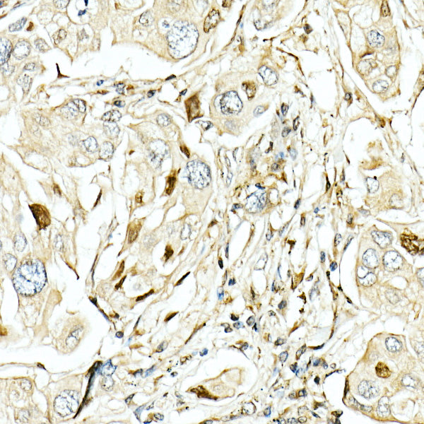 LKB1 Rabbit pAb