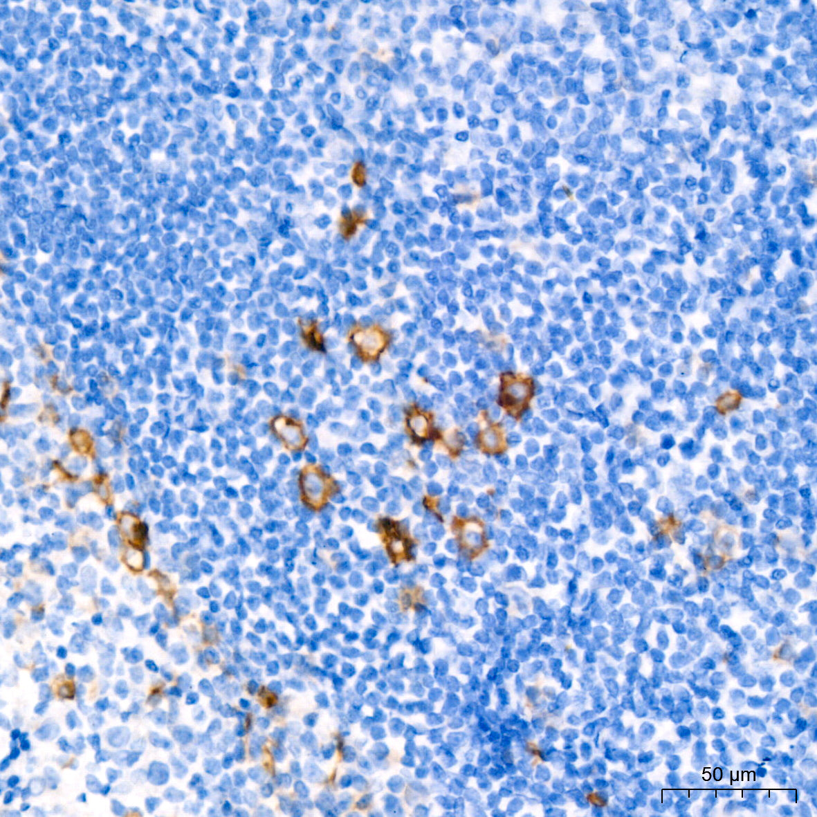 CD30 Rabbit mAb