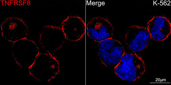CD30 Rabbit mAb
