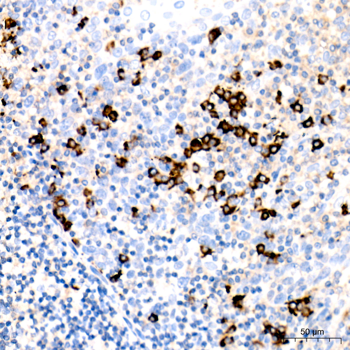 Human IgG1 (Fc) Rabbit mAb