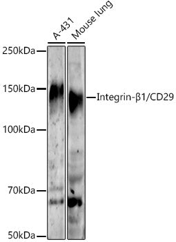Integrin-β1/CD29 Rabbit mAb