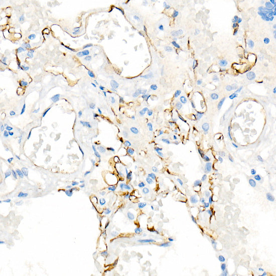 CD141/Thrombomodulin Rabbit mAb