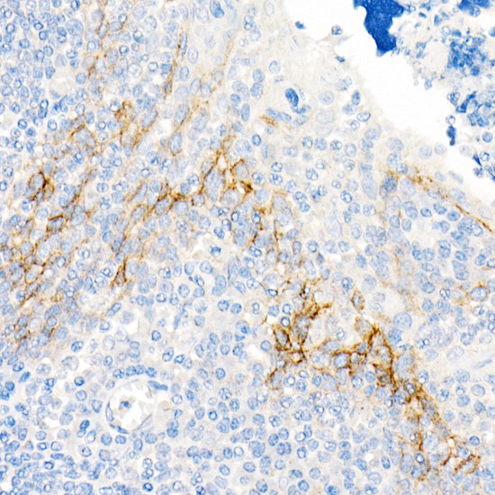 CD141/Thrombomodulin Rabbit mAb