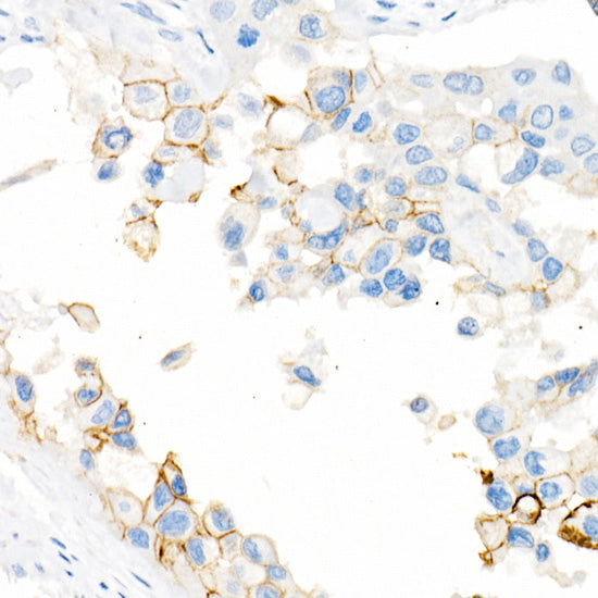 CD141/Thrombomodulin Rabbit mAb