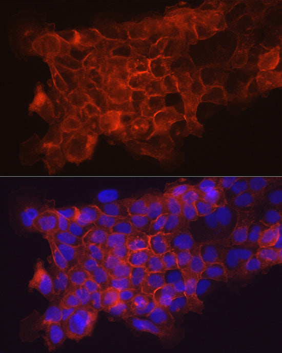 CD141/Thrombomodulin Rabbit mAb